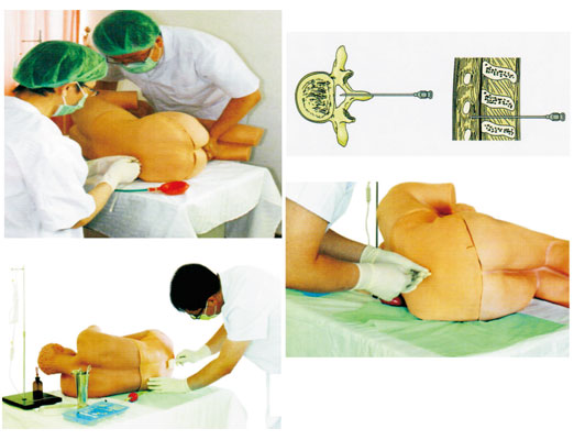 知能醫(yī)學腰椎穿刺仿真模擬人怎么用？