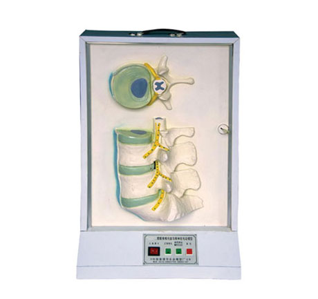 腰骶椎、椎間盤和脊神經電動模型